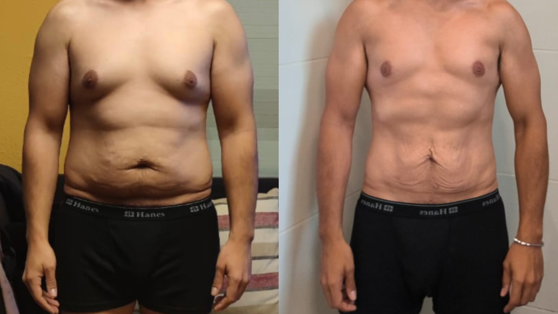 Antes y después de un cliente de Fonte Fit, entrenador personal en Mataró