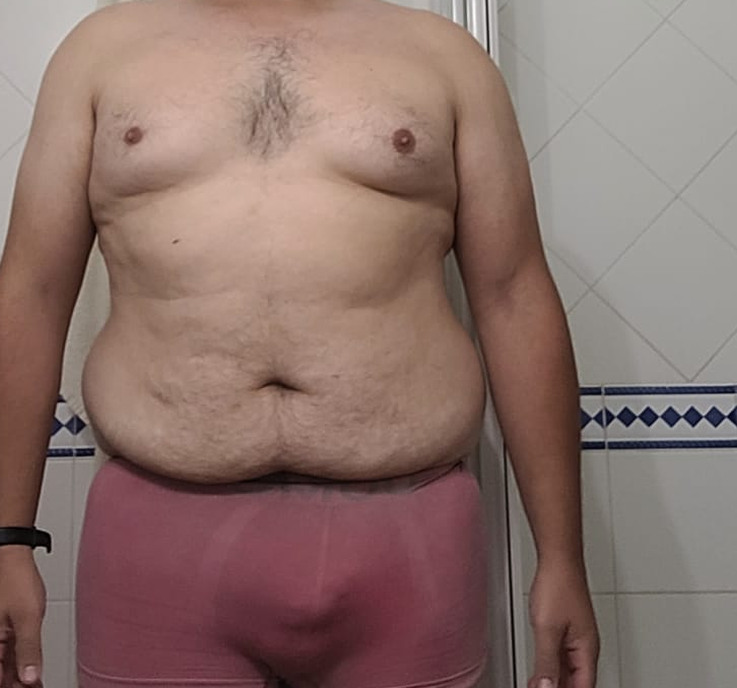 Antes
